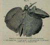 Posterior of Lover of Sumatran Rhino
