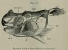 Beddard 1889 sumatrensis face dissection
